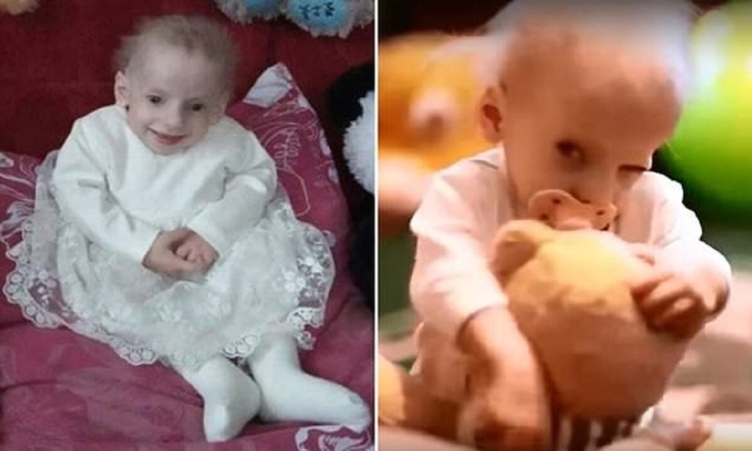 Why did a Ukrainian woman die of old age at the age of 8