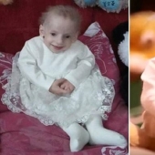 Why did a Ukrainian woman die of old age at the age of 8