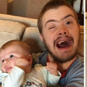 Why there are practically no people with Down syndrome in Iceland