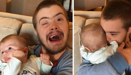 Why there are practically no people with Down syndrome in Iceland