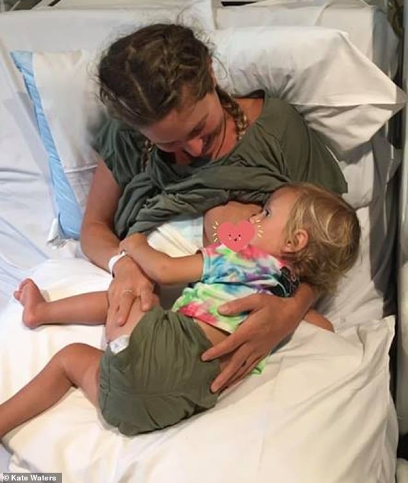 "With them, my life turned into hell": an Australian woman told why she got rid of breast implants