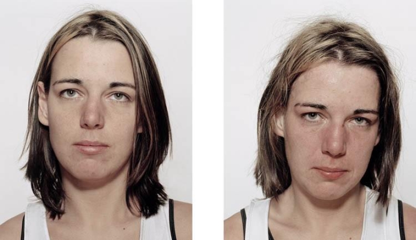 Young boxers: before and after the fight Young boxers: before and after the fight