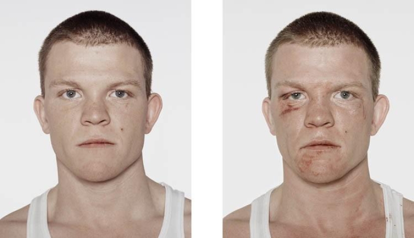 Young boxers: before and after the fight Young boxers: before and after the fight