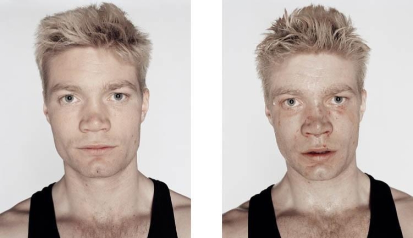 Young boxers: before and after the fight Young boxers: before and after the fight