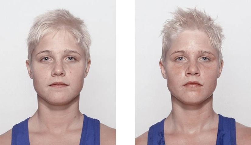 Young boxers: before and after the fight Young boxers: before and after the fight