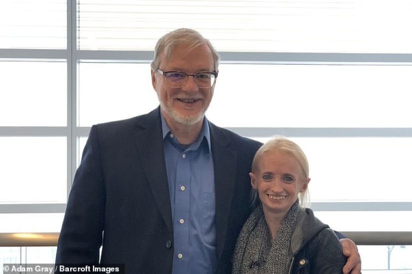 Young "old lady": a woman ages 8 times faster than usual due to "Benjamin Button" syndrome Young "old lady": a woman ages 8 times faster than usual due to "Benjamin Button" syndrome