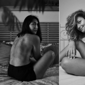 "Your ugliness is cool!": 5 people who are proud of the features of their appearance