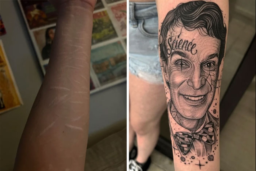 10 Before & After Pics Of Terrible Tattoos Getting Fixed, As Shared In This Online Group