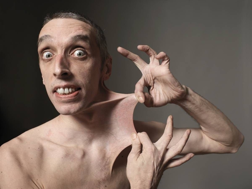 10 características del cuerpo humano que son extremadamente raras