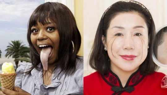 10 características del cuerpo humano que son extremadamente raras