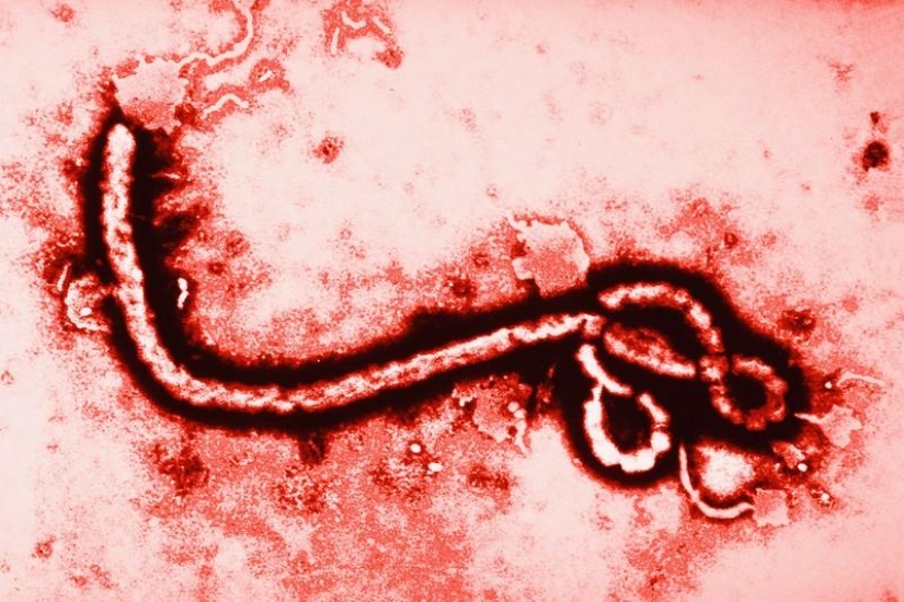 10 Ebola Facts You Should Know Today