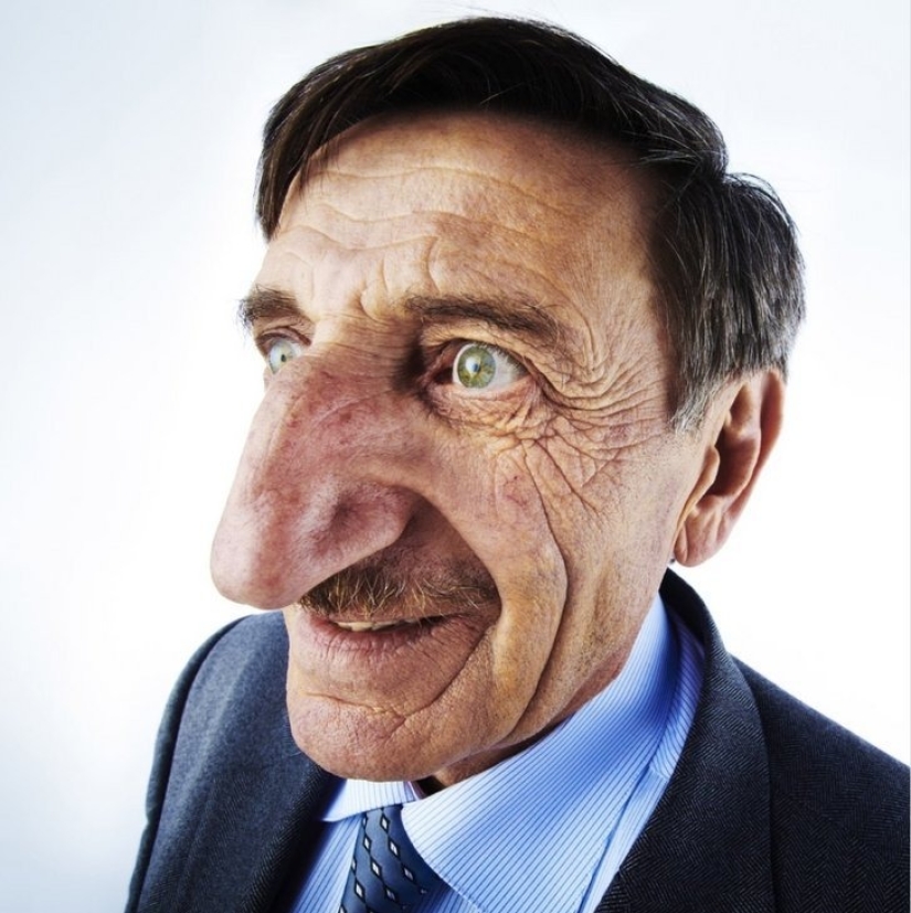 10 features of the human body that are extremely rare 10 features of the human body that are extremely rare