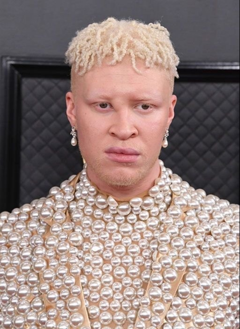 10 features of the human body that are extremely rare 10 features of the human body that are extremely rare