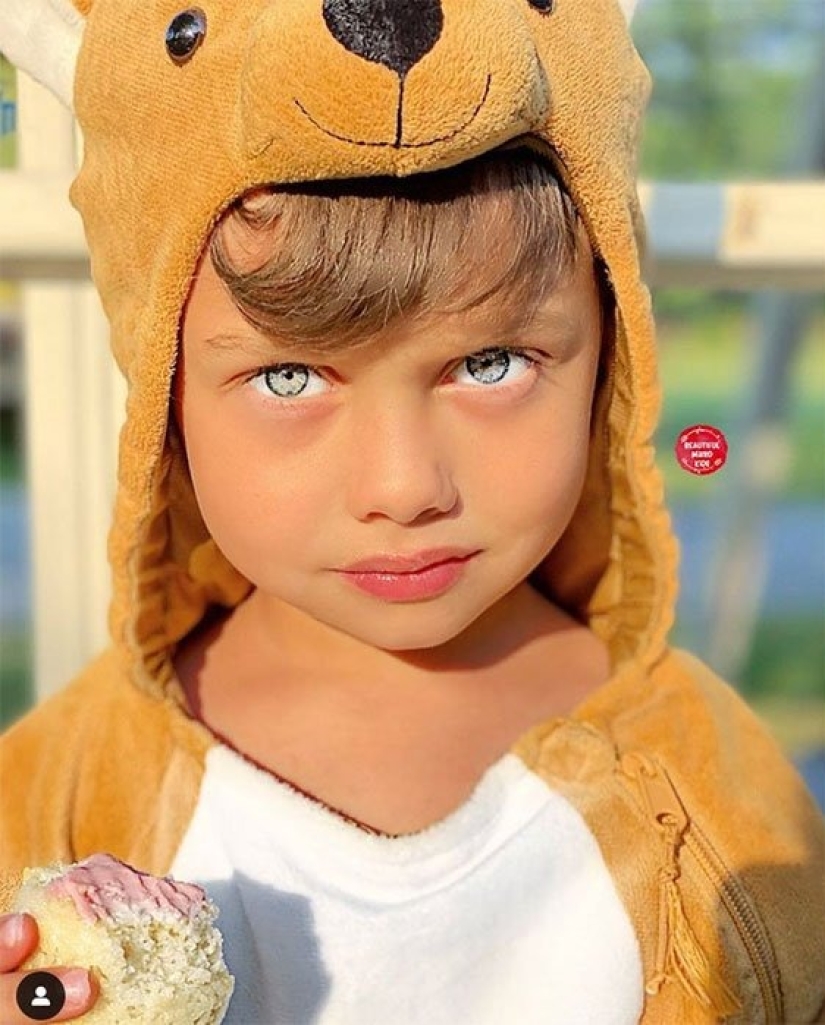 10 niños de una belleza única, y todo gracias a una combinación inusual de genes 10 niños de una belleza única, y todo gracias a una combinación inusual de genes