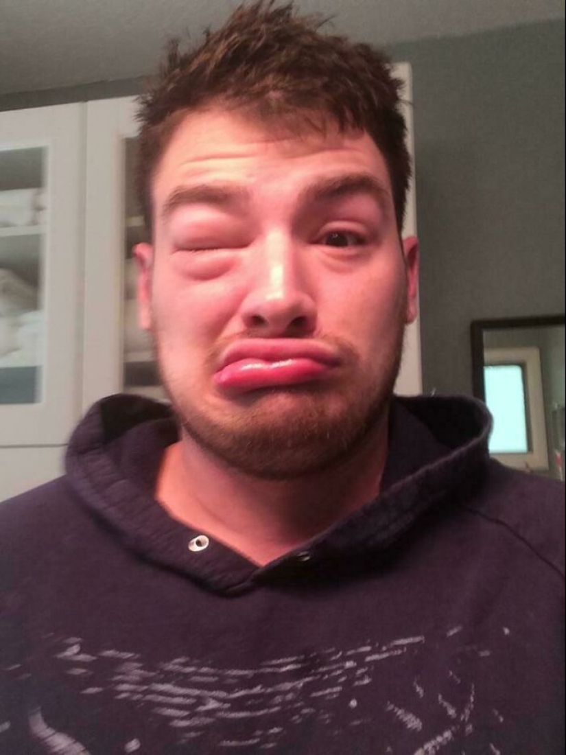 11 de las cosas más desafortunadas con las que la gente se vio obligada a lidiar (Parte 2)