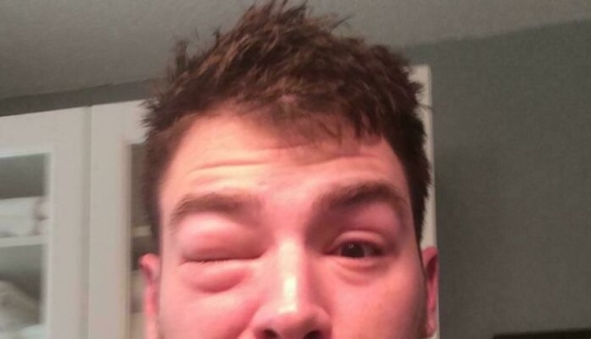 11 de las cosas más desafortunadas con las que la gente se vio obligada a lidiar (Parte 2) 11 de las cosas más desafortunadas con las que la gente se vio obligada a lidiar (Parte 2)