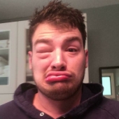 11 Of The Most Unfortunate Things That People Were Forced To Deal With (Part2)