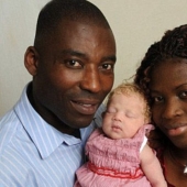 11 years ago, a "white angel" was born to a Nigerian couple. What a beauty the girl has become over the years