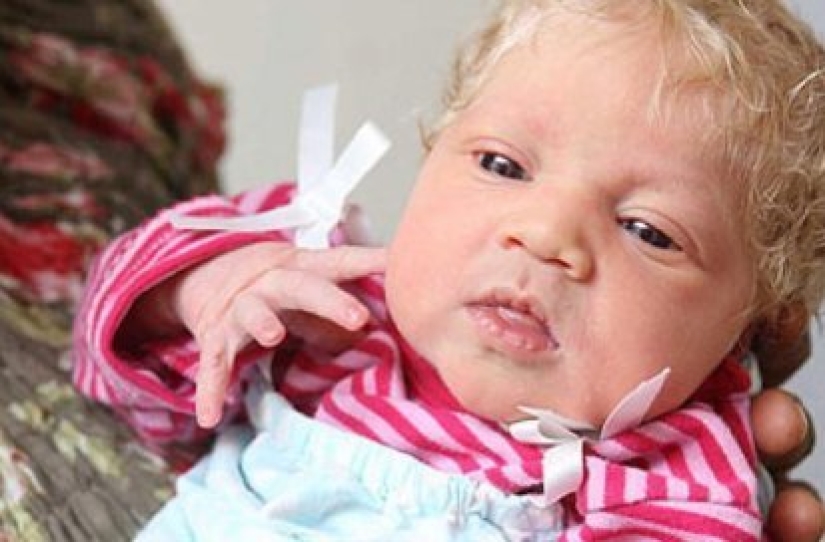 11 years ago, a "white angel" was born to a Nigerian couple. What a beauty the girl has become over the years 11 years ago, a "white angel" was born to a Nigerian couple. What a beauty the girl has become over the years