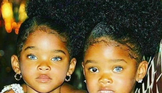 12 years have passed, twin sisters with different eye colors have grown up and become beauties 12 years have passed, twin sisters with different eye colors have grown up and become beauties