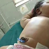 19-year-old mother gave birth to the heaviest girl weighing 6.8 kg