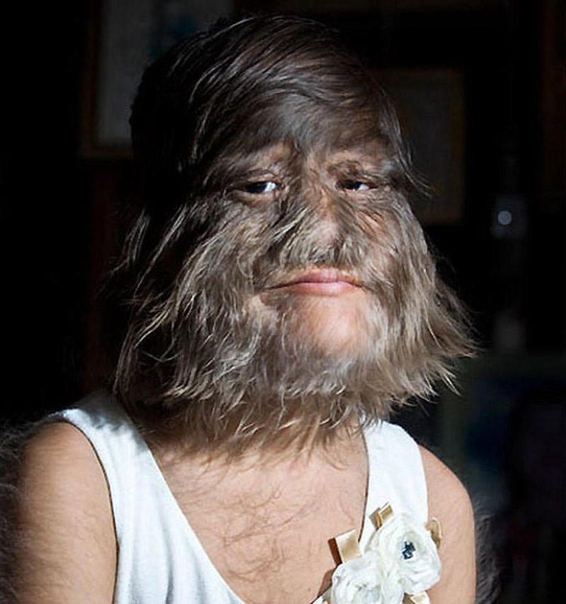 20 signs your beard is too big