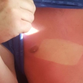 24 people who just don't know how to sunbathe