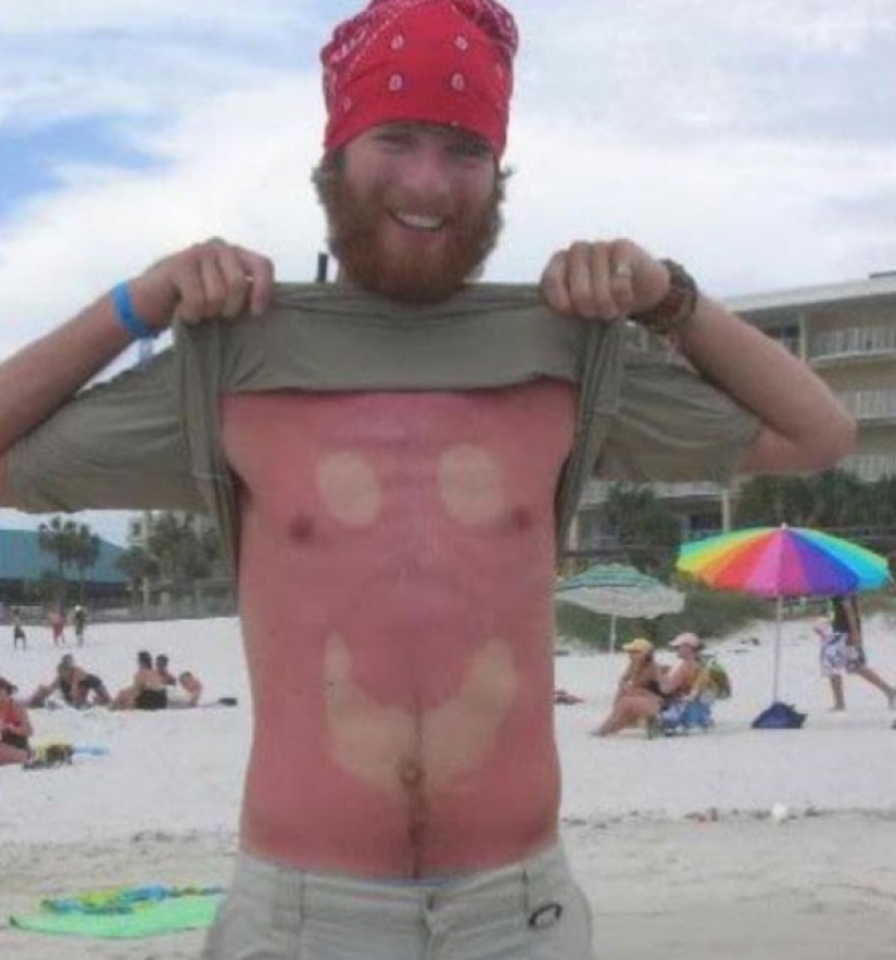 24 people who just don't know how to sunbathe 24 people who just don't know how to sunbathe