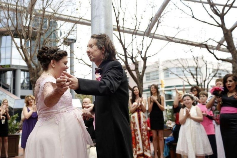 'Hombre sin rostro' se casa tras trasplante