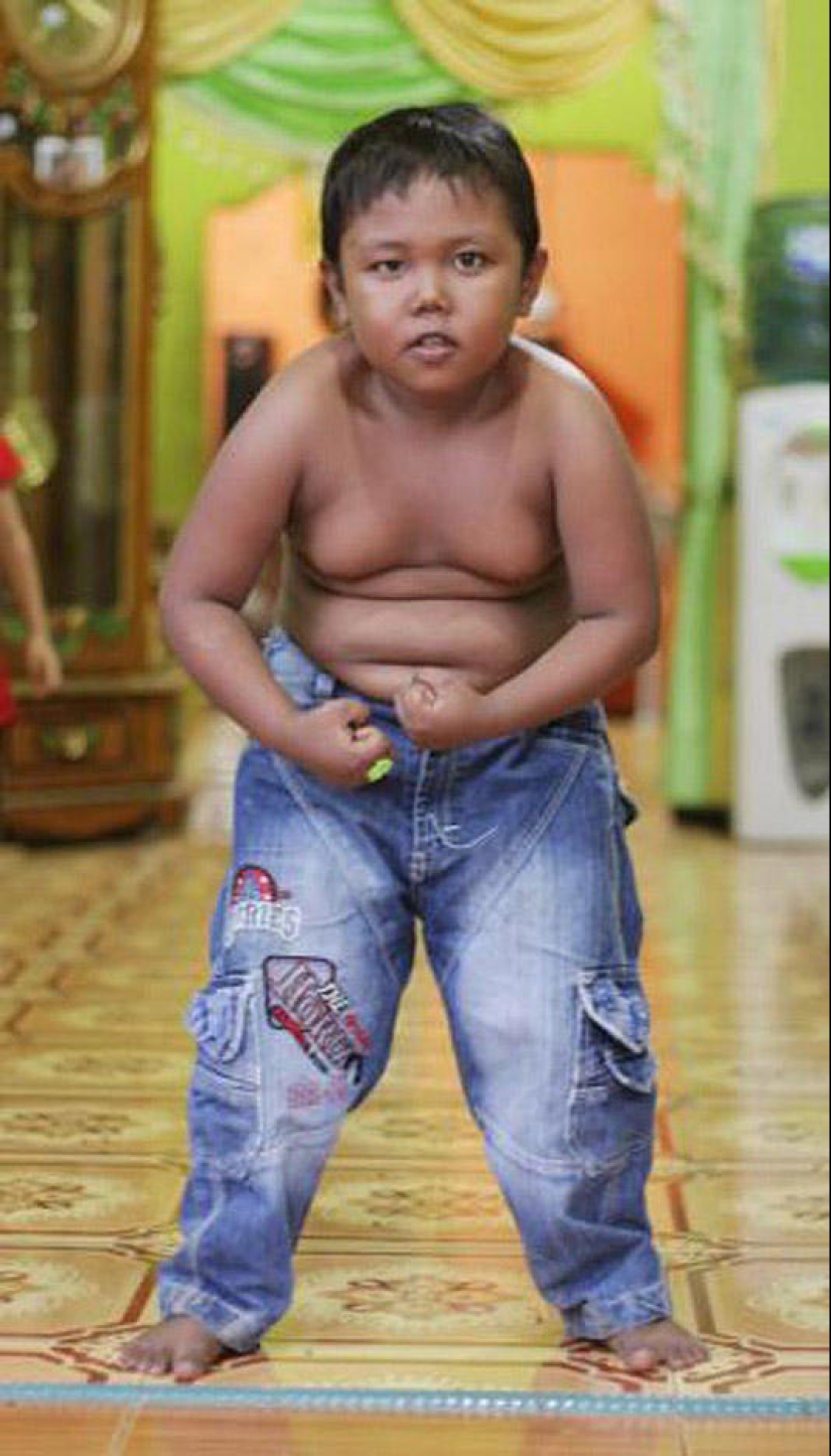 4-year-old Indonesian quit smoking and began to overeat 4-year-old Indonesian quit smoking and began to overeat