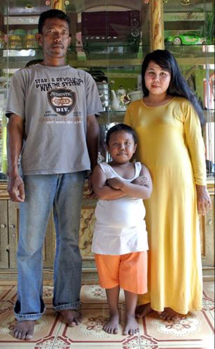 4-year-old Indonesian quit smoking and began to overeat 4-year-old Indonesian quit smoking and began to overeat