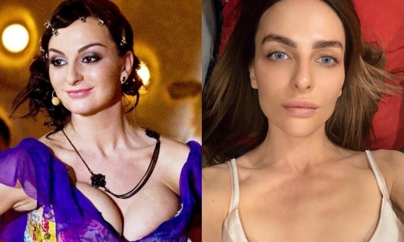 5 ejemplos de cirugía plástica exitosa y 5 casos más de “horror en las alas de la noche”