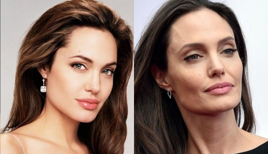 5 ejemplos de cirugía plástica exitosa y 5 casos más de “horror en las alas de la noche”