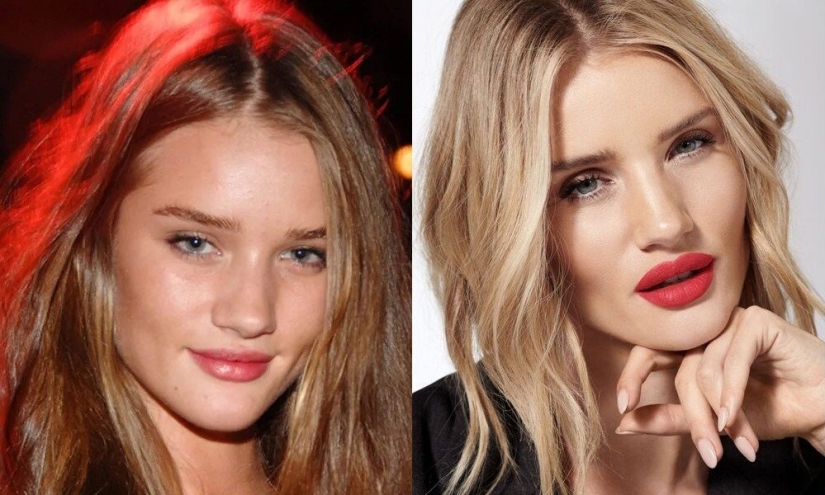 5 examples of successful plastic surgery and 5 more cases of “horror on the wings of the night” 5 examples of successful plastic surgery and 5 more cases of “horror on the wings of the night”