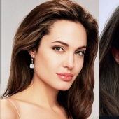 5 examples of successful plastic surgery and 5 more cases of “horror on the wings of the night”