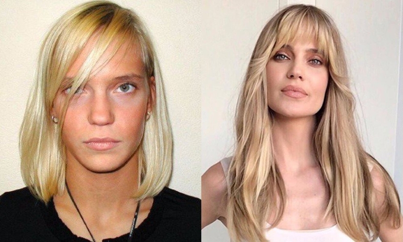 5 examples of successful plastic surgery and 5 more cases of “horror on the wings of the night” 5 examples of successful plastic surgery and 5 more cases of “horror on the wings of the night”