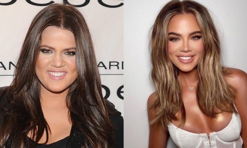 5 examples of successful plastic surgery and 5 more cases of “horror on the wings of the night” 5 examples of successful plastic surgery and 5 more cases of “horror on the wings of the night”