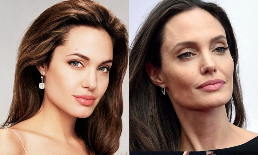 5 examples of successful plastic surgery and 5 more cases of “horror on the wings of the night” 5 examples of successful plastic surgery and 5 more cases of “horror on the wings of the night”