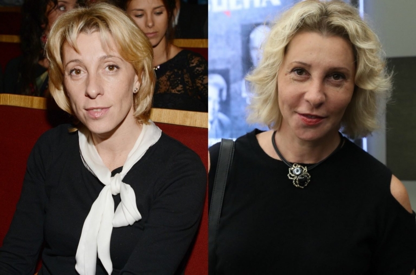 5 examples of successful plastic surgery and 5 more cases of “horror on the wings of the night” 5 examples of successful plastic surgery and 5 more cases of “horror on the wings of the night”