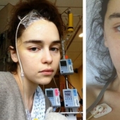 6 celebridades que se han sometido a una cirugía severa y estaban al borde de la muerte