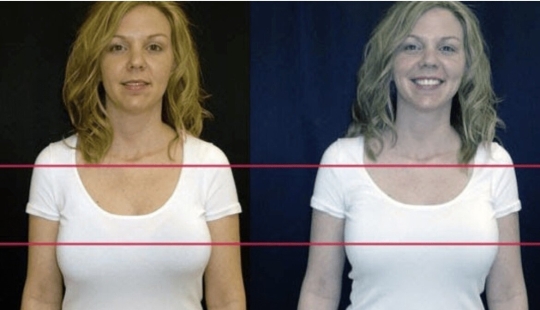 7 pequeñas cosas que harán que incluso una mujer lujosa se vea desordenada