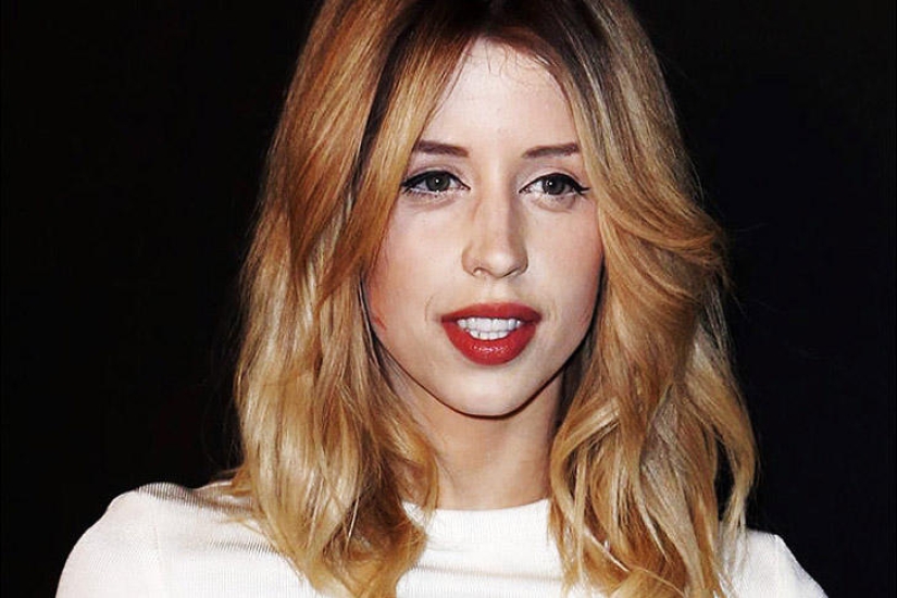 8 celebrities who died of anorexia