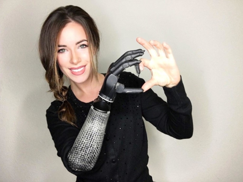 9 courageous heroes who became disabled, but did not lose their strength of spirit 9 courageous heroes who became disabled, but did not lose their strength of spirit