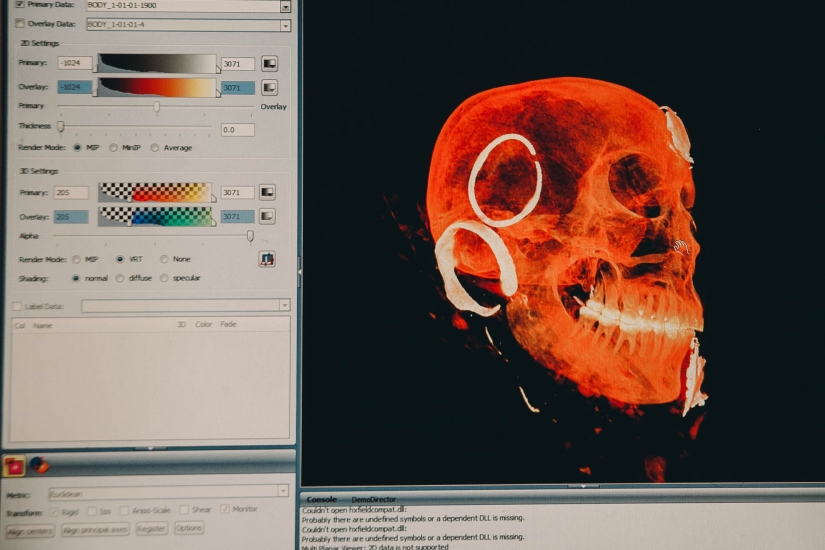 900-year-old mummy of the "Polar Princess" was unearthed in Siberia