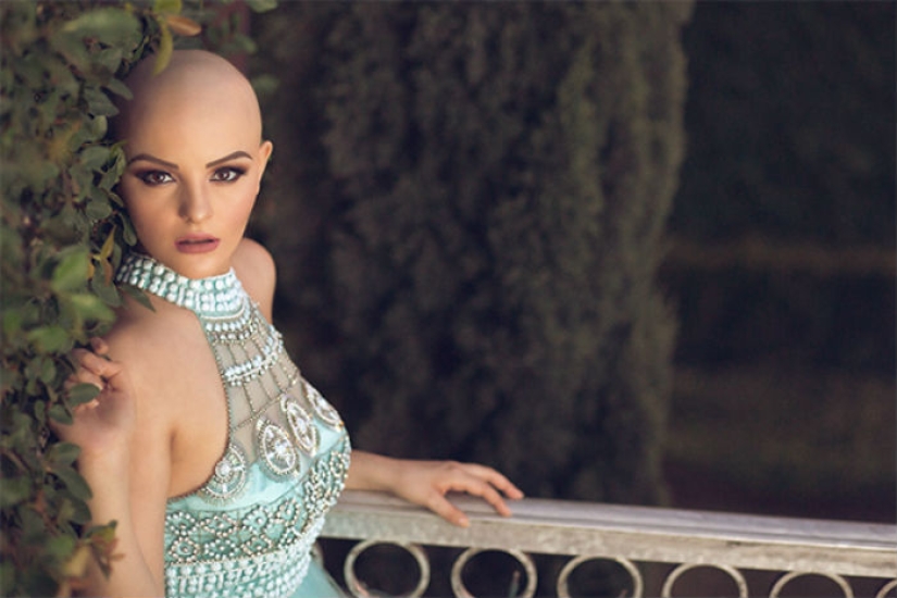 A 17-year-old girl struggling with cancer starred in a bold photo shoot without a wig A 17-year-old girl struggling with cancer starred in a bold photo shoot without a wig