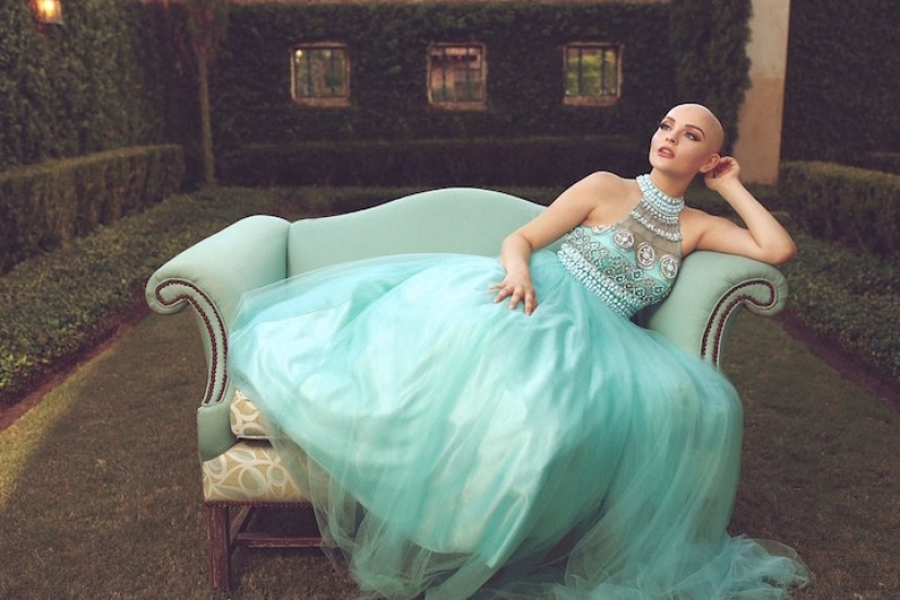 A 17-year-old girl struggling with cancer starred in a bold photo shoot without a wig A 17-year-old girl struggling with cancer starred in a bold photo shoot without a wig