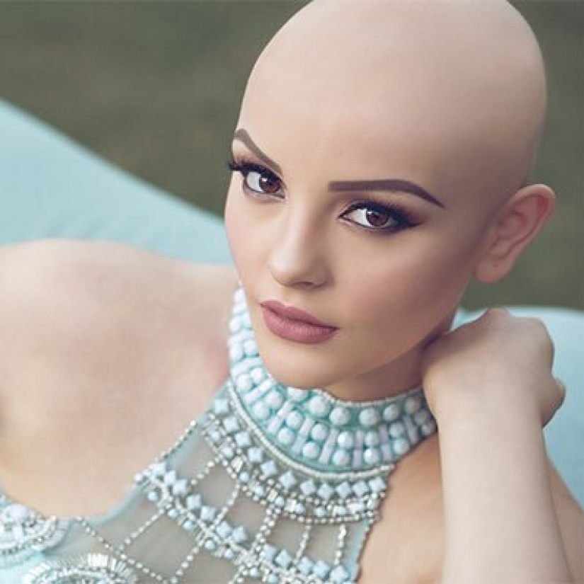 A 17-year-old girl struggling with cancer starred in a bold photo shoot without a wig A 17-year-old girl struggling with cancer starred in a bold photo shoot without a wig
