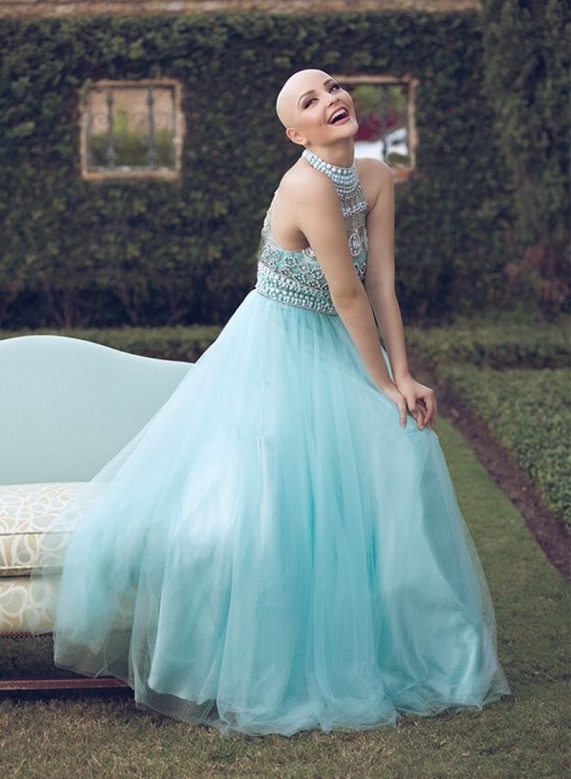 A 17-year-old girl struggling with cancer starred in a bold photo shoot without a wig A 17-year-old girl struggling with cancer starred in a bold photo shoot without a wig