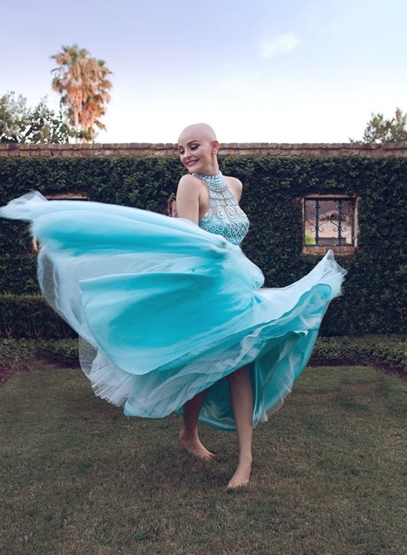 A 17-year-old girl struggling with cancer starred in a bold photo shoot without a wig A 17-year-old girl struggling with cancer starred in a bold photo shoot without a wig