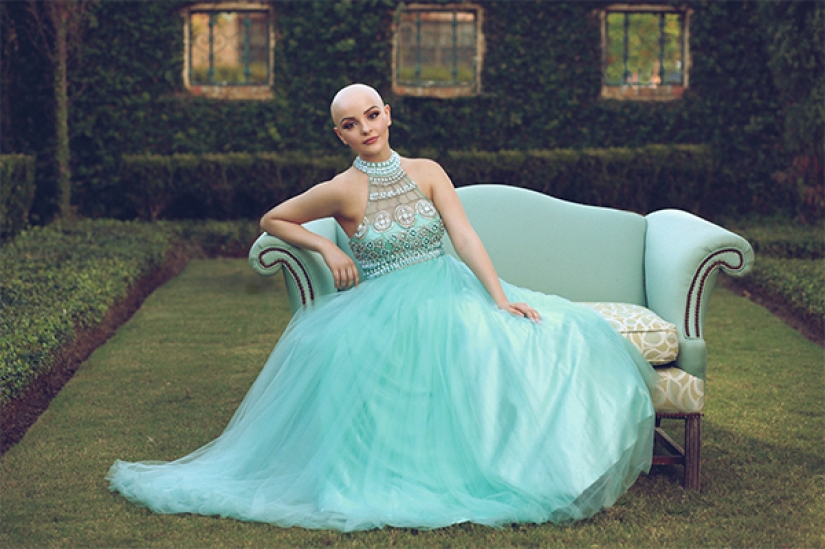 A 17-year-old girl struggling with cancer starred in a bold photo shoot without a wig A 17-year-old girl struggling with cancer starred in a bold photo shoot without a wig